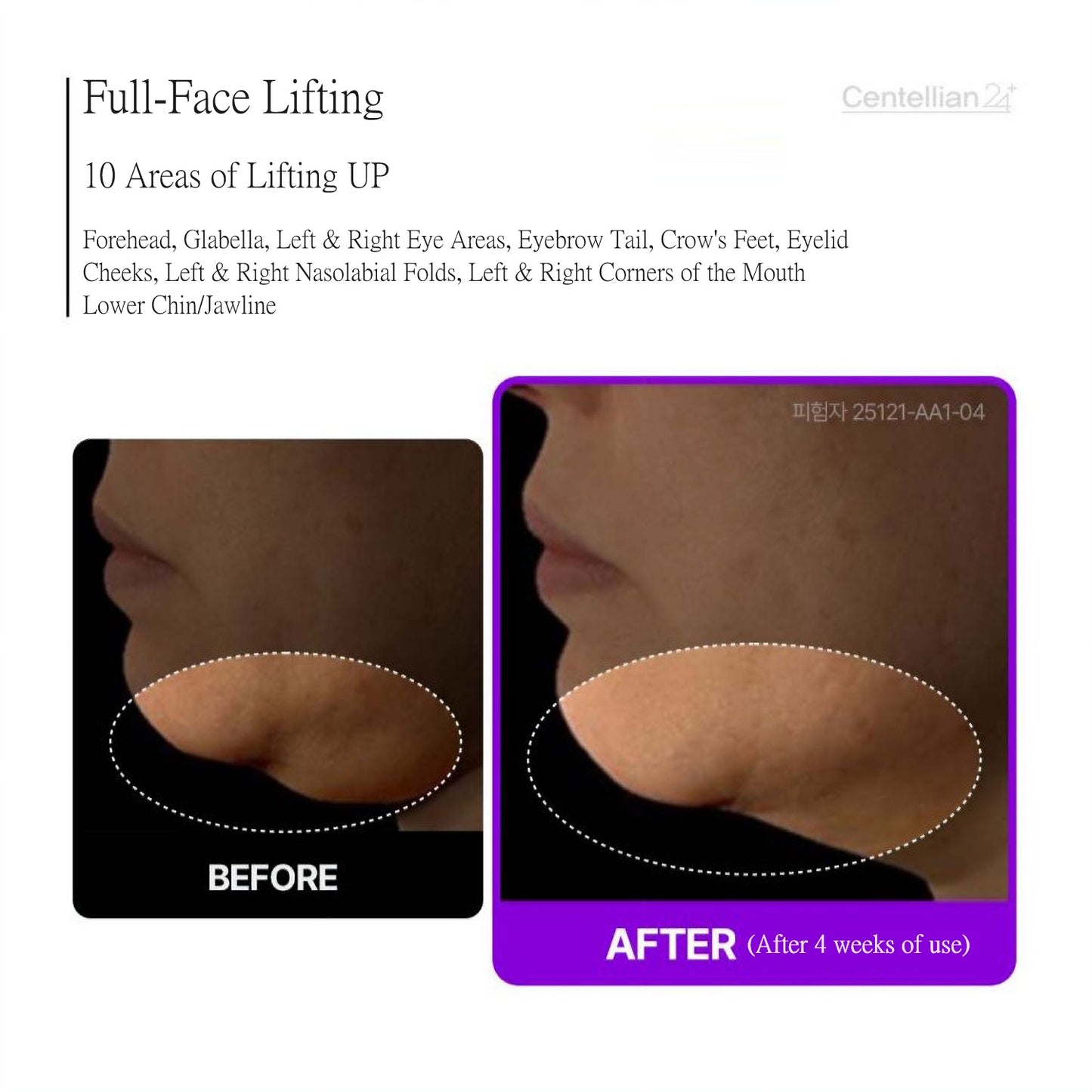 Centellian24 Madeca Cream Tight Lifting 50ml 1.7fl oz